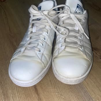 SuperStep 2 Ay İçerisinde Sararan Adidas Stan Smith