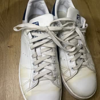 SuperStep 2 Ay İçerisinde Sararan Adidas Stan Smith
