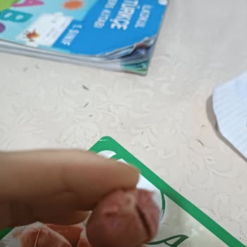 Pınar Et ve Süt Sosis Ürününde Yabancı Madde Bulunması Şikayeti