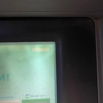 Ziraat Bankası Eksik Para Ödemesi