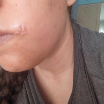 La ROCHE-POSAY Cildimi Mahvetti