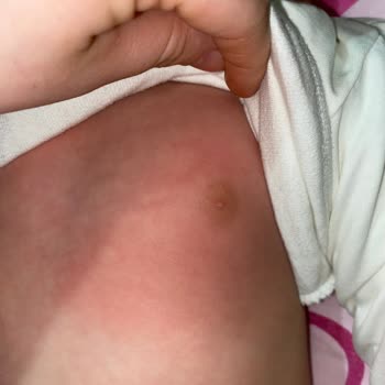 Molfix'in Sözde Harika Yeni Tasarım Bezi