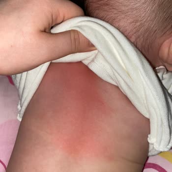 Molfix'in Sözde Harika Yeni Tasarım Bezi