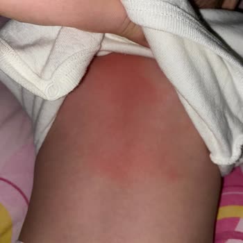 Molfix'in Sözde Harika Yeni Tasarım Bezi