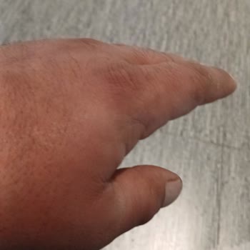 Atabay İlaç Firması Qsmak Deneyimim ve Mağduriyetim