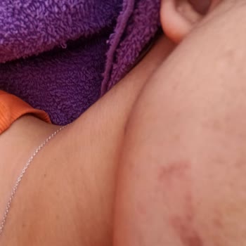 NG Güzellik Gebze Şubesinde Yanlış İşlem Kaşlarımı Mahvetti!