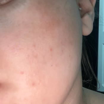 Loreal Paris Mağazaya Ulaşamıyorum Ürün Bozuk