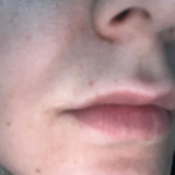 Loreal Paris Mağazaya Ulaşamıyorum Ürün Bozuk