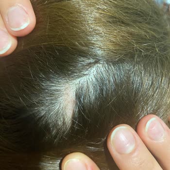 Bercislina Güzellik Merkezi Eskişehir'deki Salon Deneyimim: Masaj Değil, Saç Kaybı!