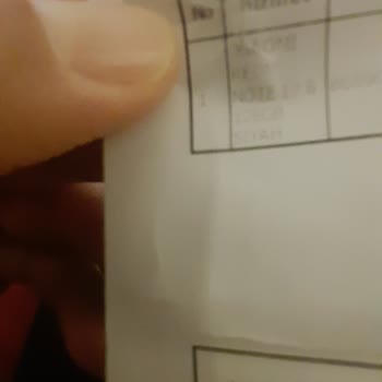 Xiaomi 2 Aylık Telefonun Servisi Gördü Görülen İşlemin Ne Olduğunu Bilmiyorum