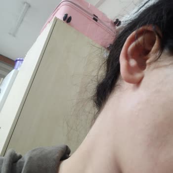 Maruderm Yağ Temizleyici Yüzüme İkinci Kutuda Alerji Yaptı, Yardımcı Olunmadı