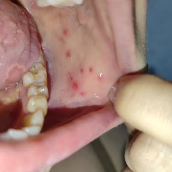 Dent Royal Beni Ağız Sağlığımdan Ettiler