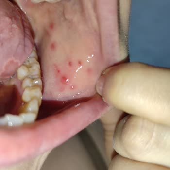 Dent Royal Beni Ağız Sağlığımdan Ettiler