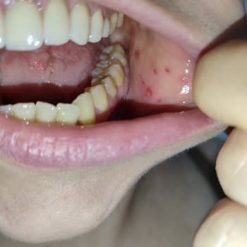 Dent Royal Beni Ağız Sağlığımdan Ettiler