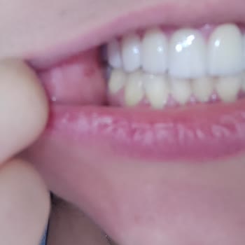 Dent Royal Beni Ağız Sağlığımdan Ettiler