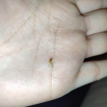 Lays İçinden Çıkan Cisim