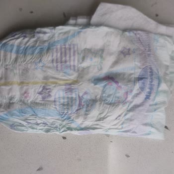 Molfix Bebek Bezi İçinde Sertlik Ve Pisik