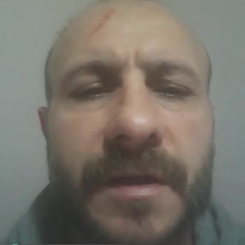 SGK Malulen Emeklilik % 72 Raporla Nasıl Olmaz?