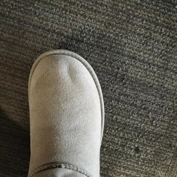 SuperStep Ugg Bot Mağduriyeti