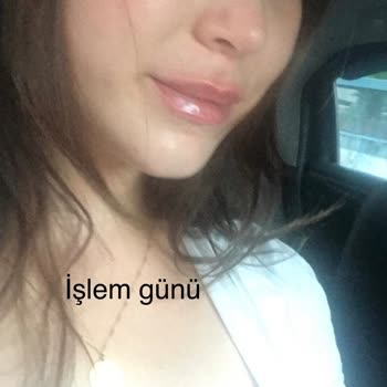 Russian Lips Quenn (Instagram: russianlips.queen) Dudak Dolgusu Vahşeti!