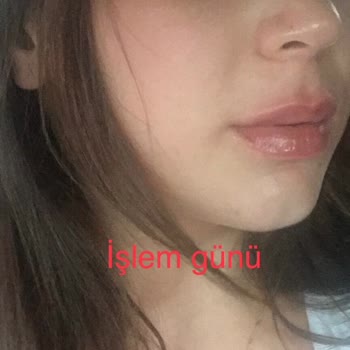 Russian Lips Quenn (Instagram: russianlips.queen) Dudak Dolgusu Vahşeti!