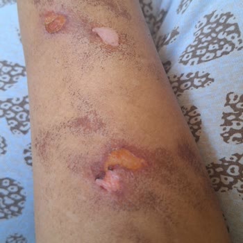 Bercislina Guzellik Merkezi Kolumu Yaktı