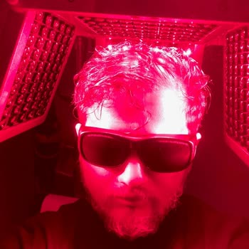 Esteworld Estetik Cerrahi Kliniği Saç Tedavileri Sonuç Vermemesi İade.