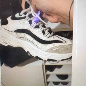 Skechers Dan Aldığım Ürünün Arkasında Durmuyor Firma