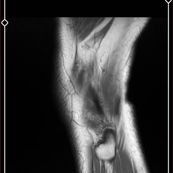 Uşak Eğitim ve Araştırma Hastanesi Ortopedi Doktoru İle İlgili Hasta Memnuniyetsizliği