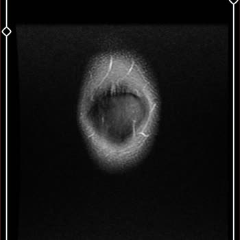 Uşak Eğitim ve Araştırma Hastanesi Ortopedi Doktoru İle İlgili Hasta Memnuniyetsizliği