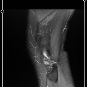 Uşak Eğitim ve Araştırma Hastanesi Ortopedi Doktoru İle İlgili Hasta Memnuniyetsizliği
