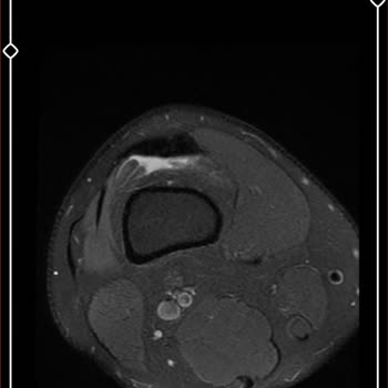 Uşak Eğitim ve Araştırma Hastanesi Ortopedi Doktoru İle İlgili Hasta Memnuniyetsizliği