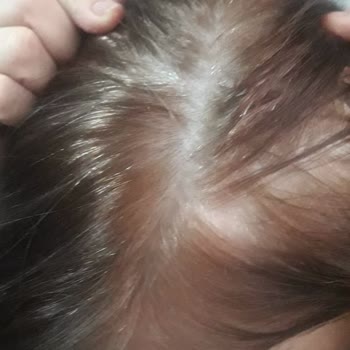 Loreal Kalitesiz Ürünler, Kalitesiz Hizmet