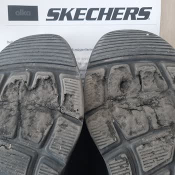 Skechers Ayakkabının Tabanı Dökülüyor...