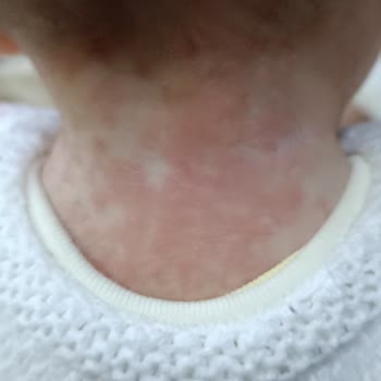 Mustela Şampuanı Çocuğumuzu Mahvetti