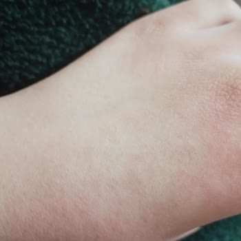 Nivea Krem Alerji Yapıyor