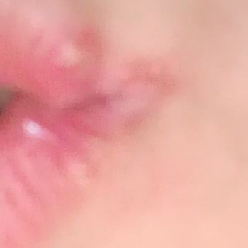 Koçak Farma İlaç Koçak Firma Dişinol