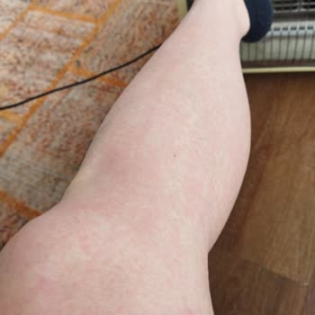 Migros Mantı Ye Mantısı Şikayeti