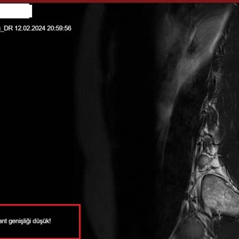 Florence Nightingale Hastaneleri Florance Gruptan Radyoloji Sonuçlarımı Alamıyorum