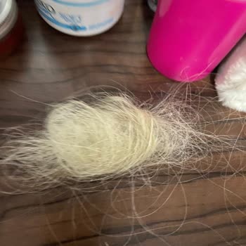 Vedat Yiğit Hair Studio Kaynaklarım Elimde Kaldı