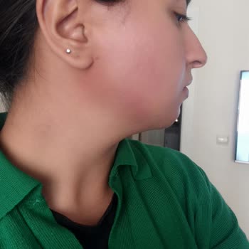 Bioderma Photoderm Spot Leke Karşıtı Güneş Kremi AL-MA-YIN!