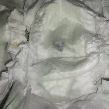 Bebem Natural Bezinde Yabancı Cisim