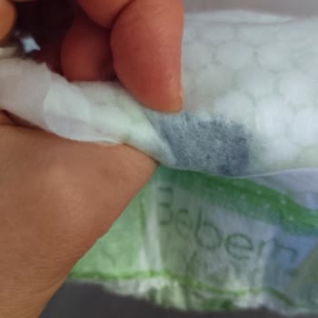 Bebem Natural Bezinde Yabancı Cisim