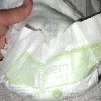 Bebem Natural Bezinde Yabancı Cisim