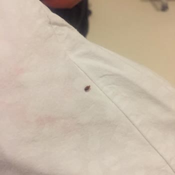 Sakarya Eğitim Ve Araştırma Hastanesi Temizlik Hakkında Şikayet