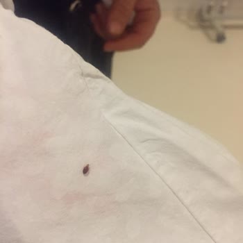 Sakarya Eğitim Ve Araştırma Hastanesi Temizlik Hakkında Şikayet