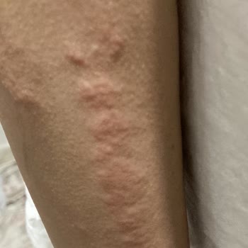 Diyetisyen & Estetisyen Sevgi Dolaşkan Güzellik Merkezinde Yaşanan Acı Tecrübe