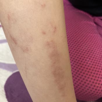 Diyetisyen & Estetisyen Sevgi Dolaşkan Güzellik Merkezinde Yaşanan Acı Tecrübe