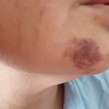 Medialkent Clinic Hastanelik Olduğum Yer