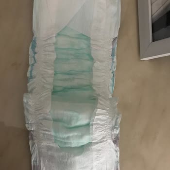 Molfix Bebek Bezi Sahte Çıktı